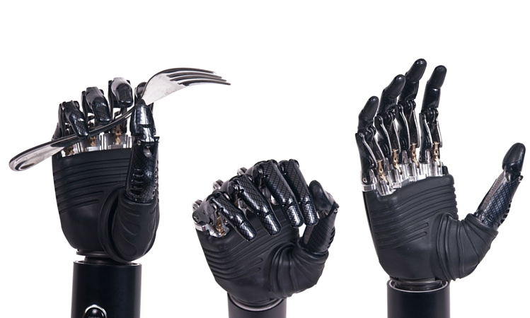 The Science Behind Fabricating Prosthetic Hands and Arms